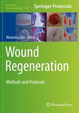 Wound Regeneration: Methods and Protocols