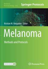 Melanoma