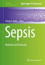 Sepsis: Methods and Protocols