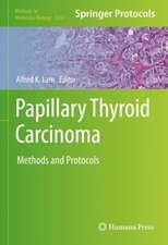 Papillary Thyroid Carcinoma: Methods and Protocols 