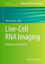 Live-Cell RNA Imaging