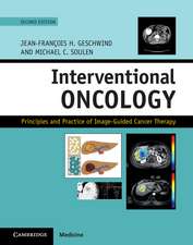 Interventional Oncology