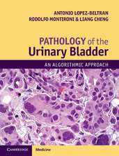 Pathology of the Urinary Bladder: An Algorithmic Approach