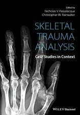 Skeletal Trauma Analysis – Case Studies in Context