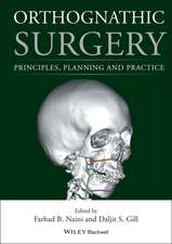 Orthognathic Surgery – Principles, Planning and Practice