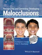 Recognizing and Correcting Developing Malocclusions – A Problem–Oriented Approach to Orthodontics