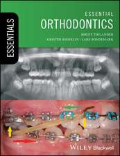 Thilander, B: Essential Orthodontics