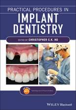 Practical Procedures in Implant Dentistry