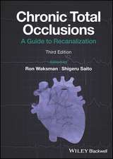 Chronic Total Occlusions: A Guide to Recanalization