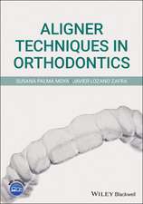 Aligner Techniques in Orthodontics