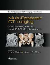 Multi-Detector CT Imaging: Abdomen, Pelvis, and CAD Applications