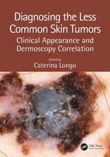 Diagnosing the Less Common Skin Tumors: Clinical Appearance and Dermoscopy Correlation