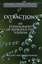 Extractions
