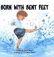 Born with Bent Feet