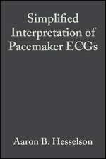 Simplified Interpretation of Pacemaker ECGs