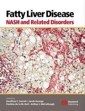 Fatty Liver Disease – NASH and Related Disorders