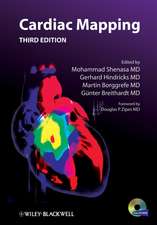 Cardiac Mapping