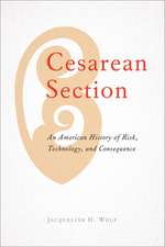 Cesarean Section