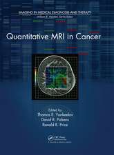 Quantitative MRI in Cancer