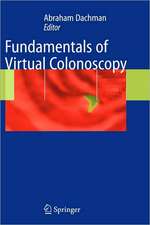 Fundamentals of Virtual Colonoscopy