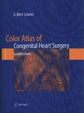 Color Atlas of Congenital Heart Surgery