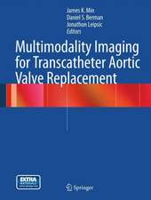 Multimodality Imaging for Transcatheter Aortic Valve Replacement