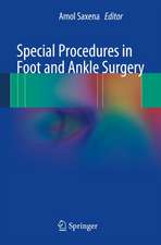 Special Procedures in Foot and Ankle Surgery