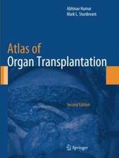 Atlas of Organ Transplantation