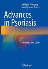 Advances in Psoriasis: A Multisystemic Guide