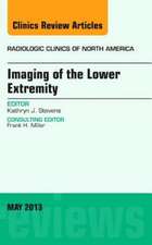 Imaging of the Lower Extremity, An Issue of Radiologic Clinics of North America