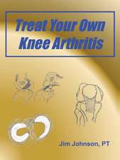 Treat Your Own Knee Arthritis