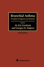 Bronchial Asthma: Principles of Diagnosis and Treatment