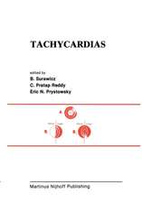 Tachycardias