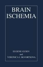 Brain Ischemia