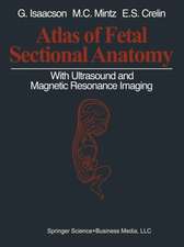 Atlas of Fetal Sectional Anatomy: With Ultrasound and Magnetic Resonance Imaging