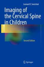 Imaging of the Cervical Spine in Children