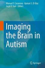 Imaging the Brain in Autism