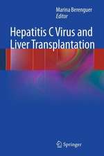 Hepatitis C Virus and Liver Transplantation