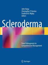 Scleroderma: From Pathogenesis to Comprehensive Management