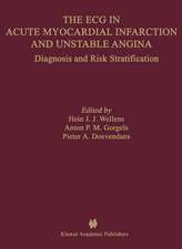 The ECG in Acute Myocardial Infarction and Unstable Angina: Diagnosis and Risk Stratification