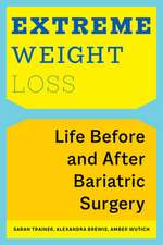 Extreme Weight Loss – Life Before and After Bariatric Surgery