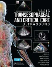 Basic Transesophageal and Critical Care Ultrasound