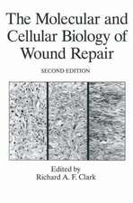 The Molecular and Cellular Biology of Wound Repair