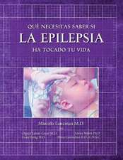 Que Necesitas Saber Si La Epilepsia Ha Tocado Tu Vida