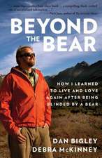 Beyond the Bear: How I Learned to Live and Love Again After Being Blinded by a Bear