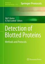 Detection of Blotted Proteins: Methods and Protocols