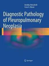 Diagnostic Pathology of Pleuropulmonary Neoplasia