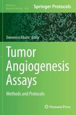 Tumor Angiogenesis Assays: Methods and Protocols