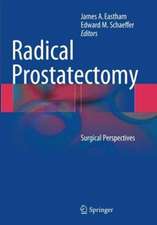 Radical Prostatectomy: Surgical Perspectives