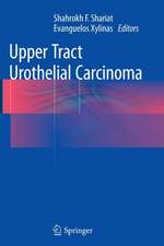 Upper Tract Urothelial Carcinoma